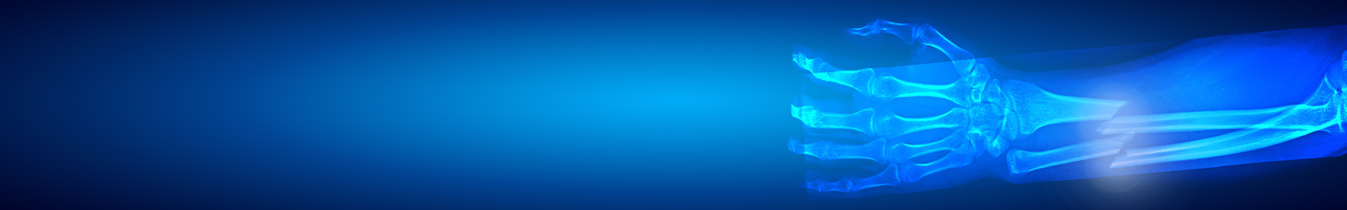 Blue X‑ray illustration of forearm bones